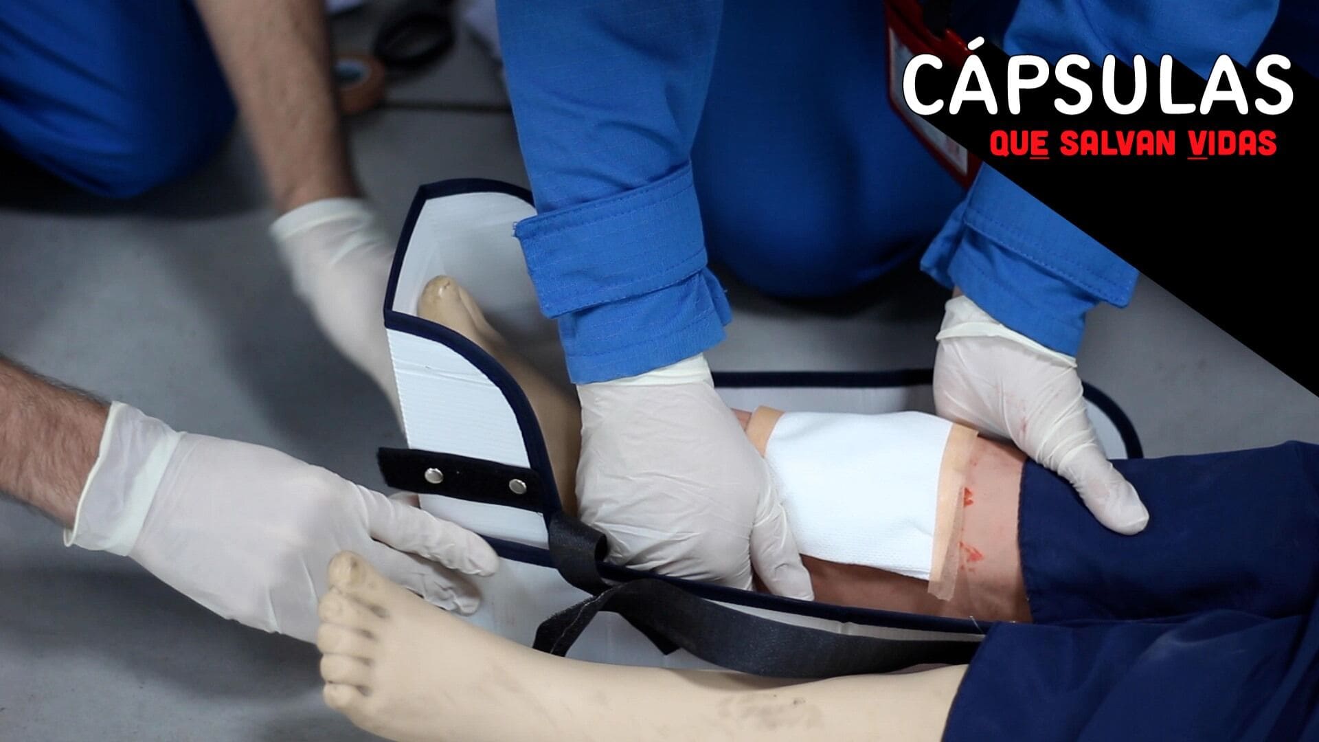 Cápsulas que salvan vidas: ¿Cómo atender una fractura?